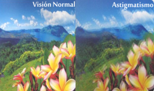 ¿Cómo afecta el astigmatismo a los estudiantes?