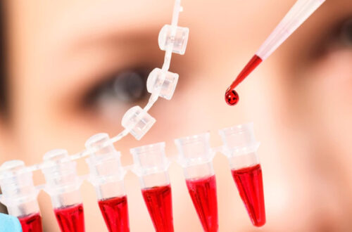 especialista analizando sangre